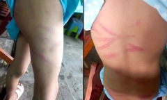 Vụ bé 6 tuổi bị mẹ ruột đánh đập dã man ở Hậu Giang: Hé lộ nguyên nhân