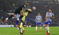 Hậu vệ Arsenal lần thứ hai mất răng khi đang thi đấu ở Ngoại hạng Anh