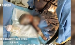 Mẹ phát bệnh làm rơi con trai 1 tuổi vào lò lửa, hành động sau đó của ông bố gây phẫn nộ tột cùng