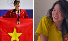 Bị nghi phẫu thuật thẩm mỹ,