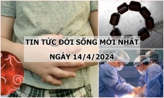 Tin tức đời sống ngày 14/4/2024: Gắp hơn 30 con giun đũa ra khỏi đường ruột bé 5 tuổi