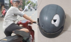 Điều tra vụ người đàn ông bị đánh thủng mũ bảo hiểm, chấn thương đầu khi đi trên đường ở TP.HCM