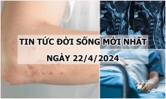 Tin tức đời sống ngày 22/4/2024: Hà Nội ghi nhận ca mắc sởi đầu tiên trong năm 2024