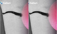 Clip: Bác sĩ sốc nặng khi thấy con vật mắc kẹt bên trong mũi bé gái 