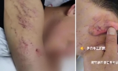Học sinh bị đánh hội đồng, phụ huynh bức xúc vì cách xử lý 