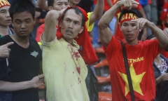 CĐV Việt Nam bị fan cuồng Malaysia đánh chảy máu đầu