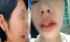 Vụ phụ huynh xông vào nhà đánh cô giáo: UBND tỉnh Đắk Nông chỉ đạo khẩn