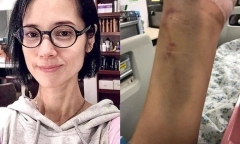Tin tức sao Hoa ngữ mới nhất ngày 15/9: Ngôi sao phim người lớn mắc bệnh nặng, kinh tế khó khăn