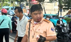 Đang làm nhiệm vụ, cảnh sát giao thông bị người đàn ông nước ngoài tấn công gây thương tích