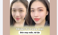 Bi hài chuyện 
