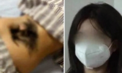 Cô gái 17 tuổi mắc bệnh lạ khiến lông mọc dày ở lưng