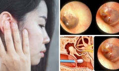 Nguy hiểm khôn lường từ thói quen