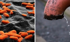 Sử dụng nguồn nước nhiễm vi khuẩn E.Coli, nguy cơ đối mặt với bệnh nguy hiểm