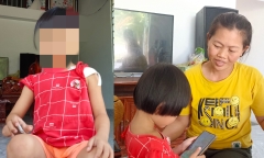 Vụ bé gái bị bố bạo hành rạn xương vai: Người mẹ đau đớn tiết lộ nguyên nhân