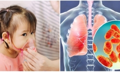 Khí hậu ẩm ướt mưa nhiều làm tăng nguy cơ mắc bệnh viêm phổi