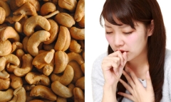 Uống thuốc ho không khỏi, đi khám phát hiện mảnh hạt điều trong phổi