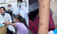 Mang mèo hoang về nuôi, cô gái khiến gia đình 4 người phải gặp bác sĩ gấp