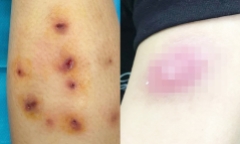 Bi hài hậu vận sau thẩm mỹ: 