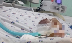 Nghi đánh bé trai 6 tháng tuổi dập não, bảo mẫu bị bắt khẩn cấp 