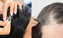 Có nên nhổ tóc bạc hay không? Câu trả lời khiến ai cũng bất ngờ