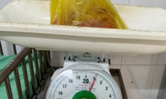 Người đàn ông nhập viện cấp cứu do khối u mỡ khổng lồ hiếm gặp ở vùng kín 