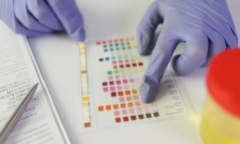 Bị suy thận nước tiểu sẽ có màu gì?