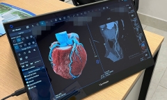 Phân biệt đột tử và đột quỵ: Dấu hiệu nhận biết sớm để cứu sống kịp thời