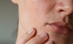 Có 7 dấu hiệu này trên da có thể thận đang 