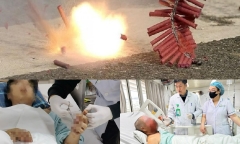 Cảnh báo nguy cơ tai nạn pháo nổ: Nhiều ca nguy kịch, di chứng nặng nề