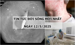 Tin tức đời sống 12/5: Nguyên nhân khiến cụ bà đau bụng âm ỉ suốt nhiều ngày