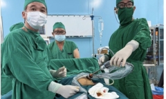 Tin tức đời sống 17/9: Bóc khối u có chứa da, tóc cho nữ bệnh nhân ở Côn Đảo