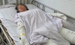 Dùng cồn sát khuẩn nướng mực, 3 người trong một gia đình thương vong