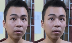 Bị tát vì không ăn cơm, thích uống nước ngọt, nghịch tử chém bố ruột trọng thương