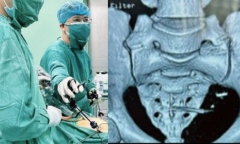Tiến hành phẫu thuật lấy dụng cụ tránh thai 