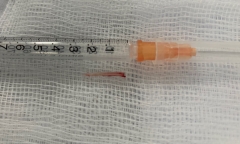 Tin tức đời sống ngày 12/1: Bé 3 tuổi suýt chết vì mảnh xương cá đâm trúng vị trí hiểm