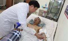 Tin tức đời sống ngày 28/2: Người đàn ông đứt rời cánh tay sau khi ngã giàn giáo cao hơn 8m