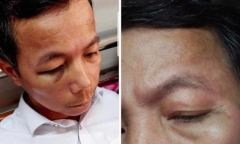 Vụ hiệu trưởng đánh hiệu phó nhập viện: Cả hai bị xử phạt hành chính
