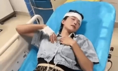 Thử độ cứng của đầu: Cô gái dùng đầu “bổ” dưa để rồi nhận cái kết đắng
