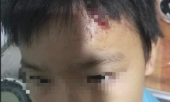 Làm rõ nghi vấn mẹ kế liên tục bạo hành con riêng của chồng ở Cà Mau