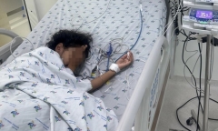Chơi trước sân nhà, bé gái 11 tuổi bị ong vò vẽ đốt 52 vết nguy kịch 