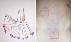 Con trai hào hứng khoe vừa làm ảo thuật trên lớp, mẹ nghe xong hoảng hồn đưa ngay đi viện