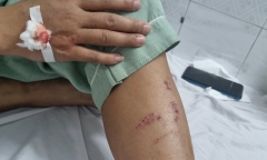 Mâu thuẫn cá nhân, một luật sư bị tông ngã văng xuống đường phải nhập viện