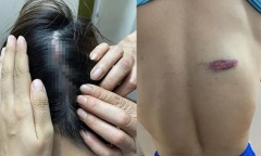 Điều tra vụ vận động viên đấu kiếm bị đồng đội hành hung nhập viện