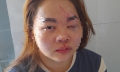 Xem xét kỷ luật thầy giáo đánh vợ phải nhập viện