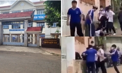 Nam sinh lớp 9 bị bạn đánh hội đồng gãy ngón tay: Công an mời nhóm học sinh lên làm việc