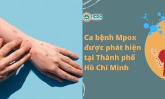 TP.HCM: Phát hiện, khoanh vùng 8 trường hợp tiếp xúc 2 bệnh nhân mắc đậu mùa khỉ