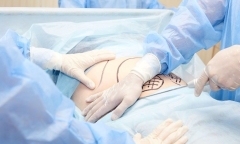Định mệnh nghiệt ngã từ sai sót y khoa Đông-Tây: Thủng màng phổi khi phẫu thuật thẩm mỹ, cựu người mẫu tử vong thương tâm