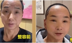 Bị nhầm thành ông nội của con, người đàn ông chi tiền “khủng” để căng da mặt và cái kết gây choáng
