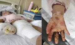 Mẹ kế ra tay tàn nhẫn với con riêng của chồng