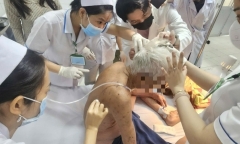Cụ ông 74 tuổi tử vong thương tâm do ong đốt hơn 100 vết